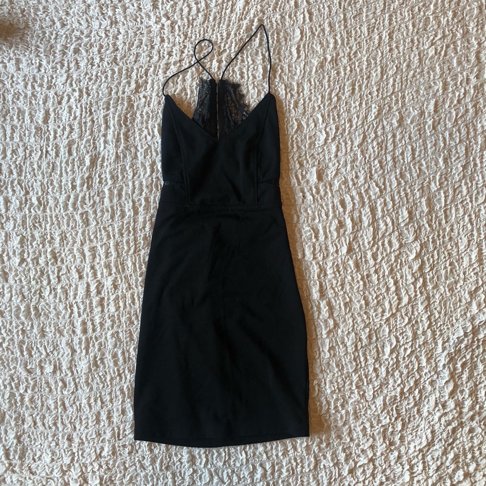 Tobi black dress with lace back